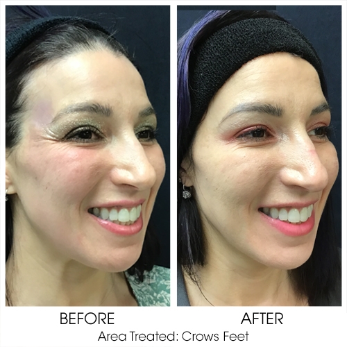 Before + After Gallery: Face