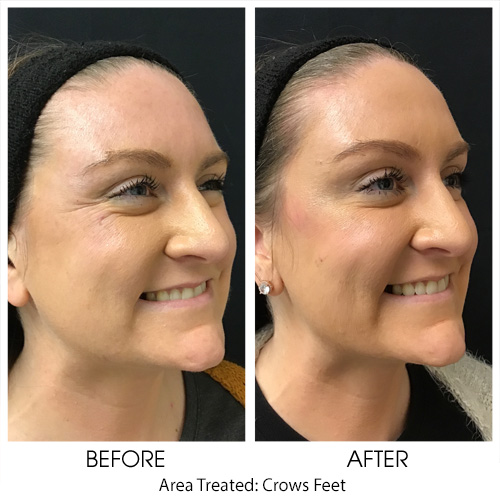 Before + After Gallery: Face