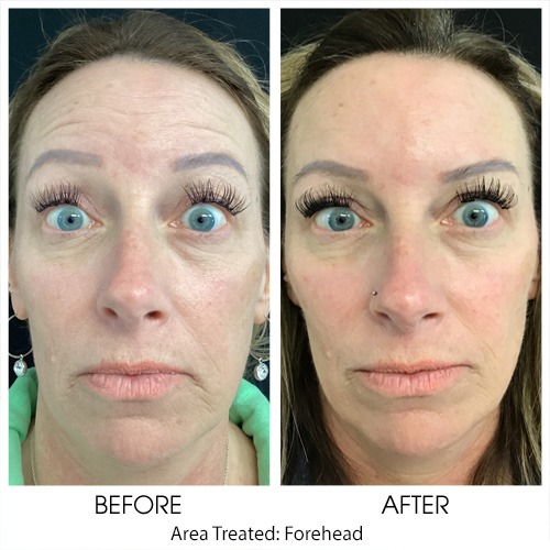 Before + After Gallery: Face