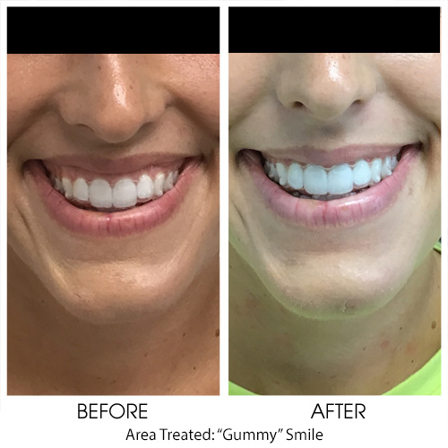 Before + After Gallery: Face