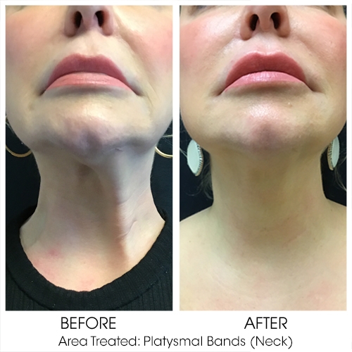 Before + After Gallery: Face