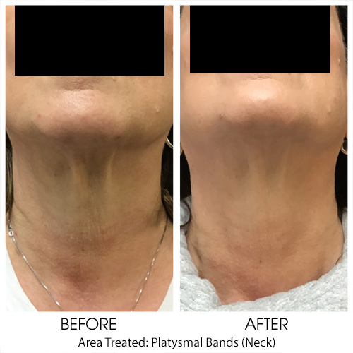 Before + After Gallery: Face