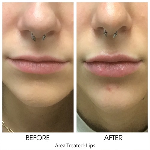 Before + After Gallery: Face