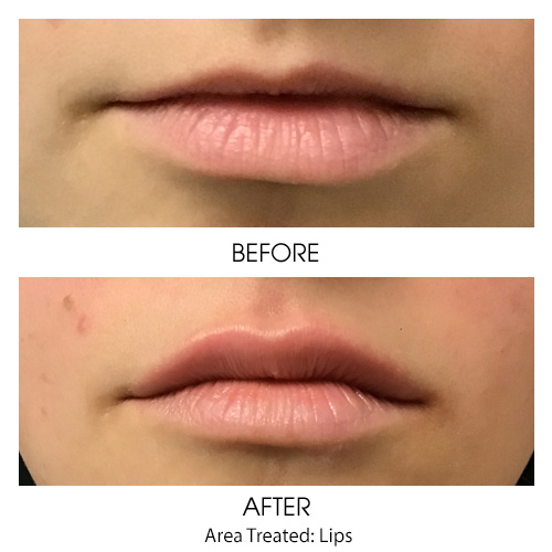 Before + After Gallery: Face