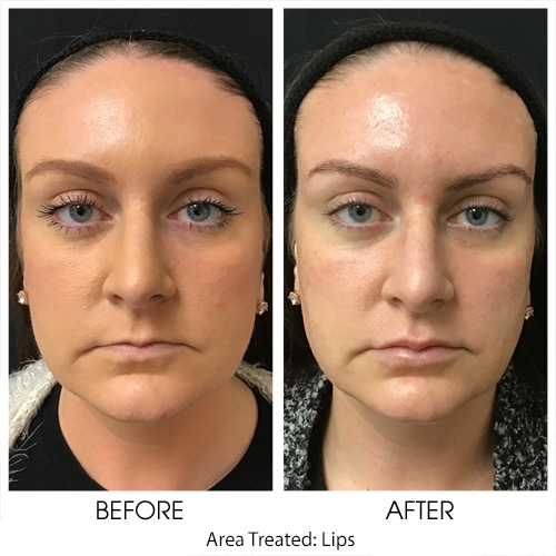 Before + After Gallery: Face