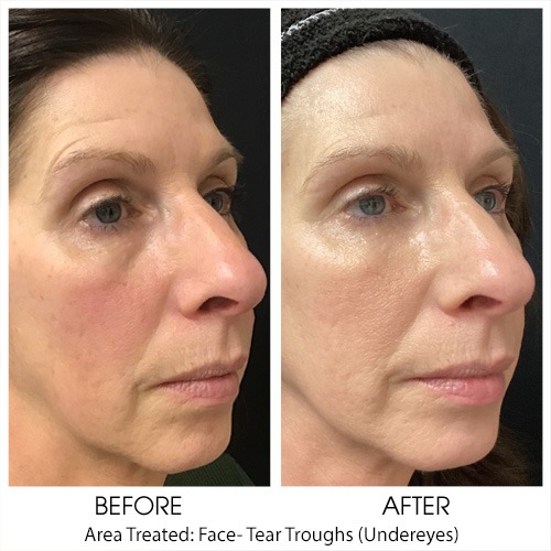 Before + After Gallery: Face
