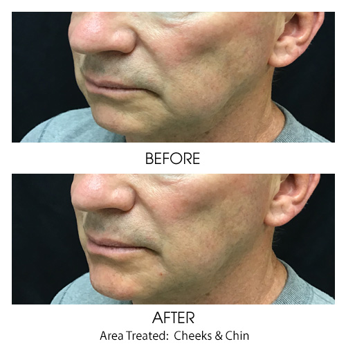 Before + After Gallery: Face