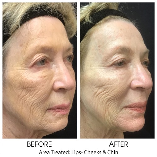 Before + After Gallery: Face
