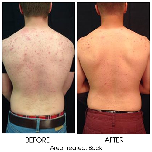Before + After Gallery: Face