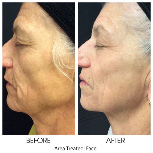 Before + After Gallery: Face