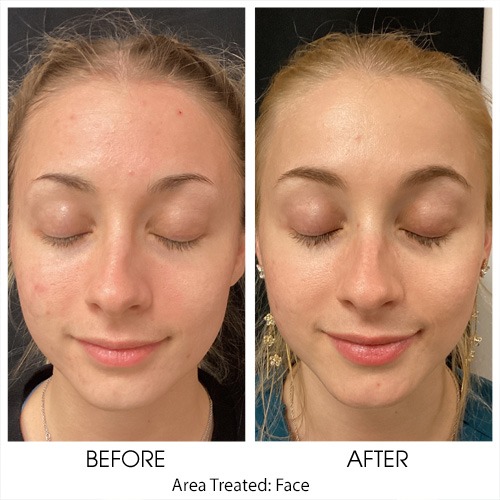 Before + After Gallery: Face