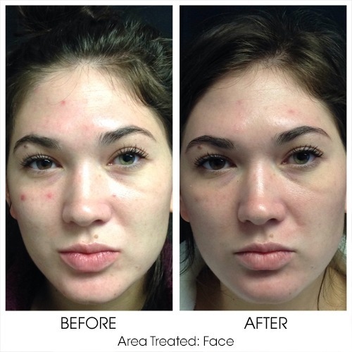 Before + After Gallery: Face