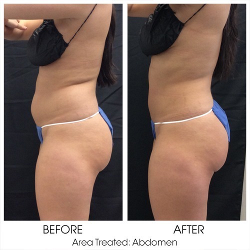 Before + After Gallery: Body