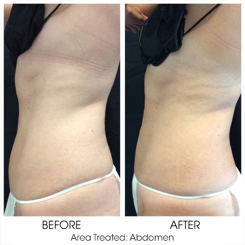 Before + After Gallery: Body