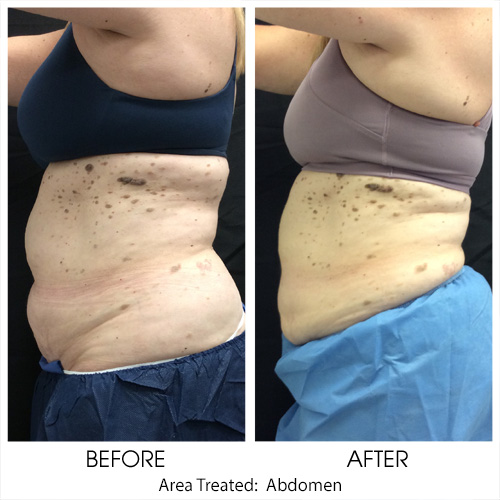 Before + After Gallery: Body