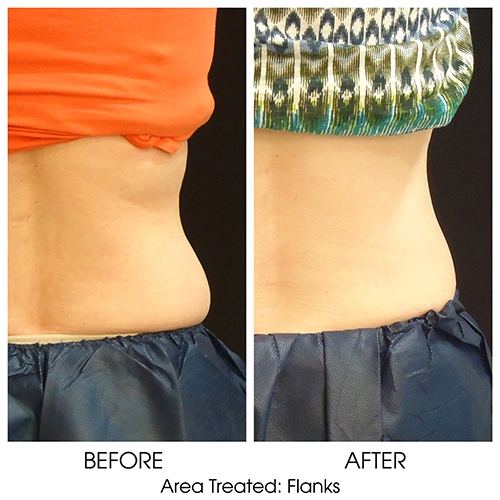 Before + After Gallery: Body