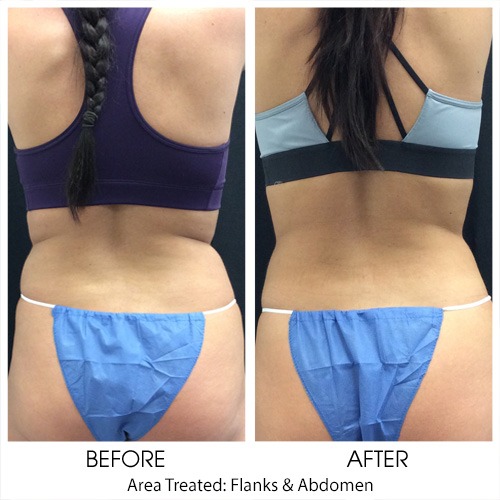 Before + After Gallery: Body