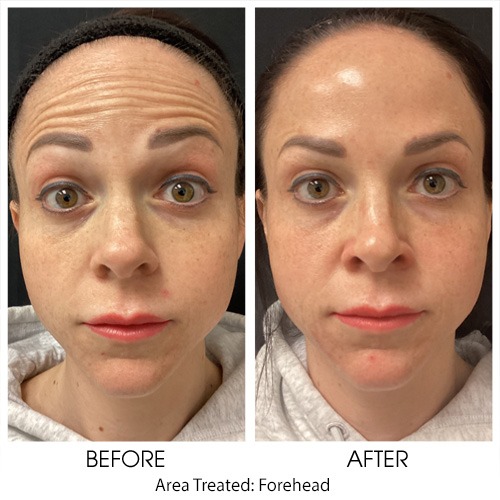 Before + After Gallery: Face
