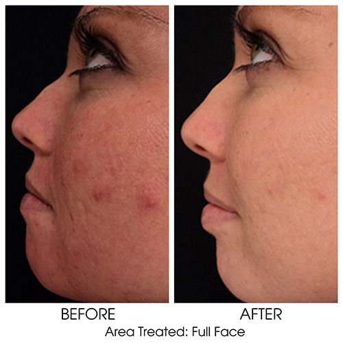 Before + After Gallery: Face