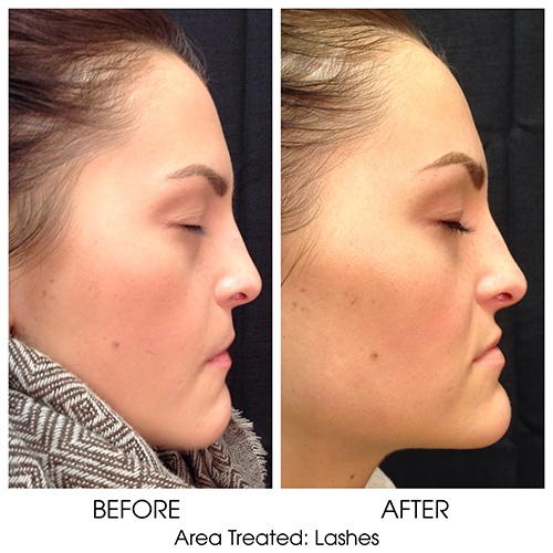 Before + After Gallery: Face