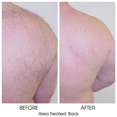 Before + After Gallery: Face