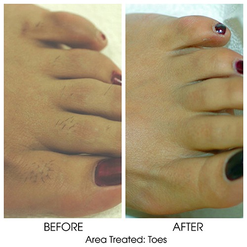 Before + After Gallery: Face
