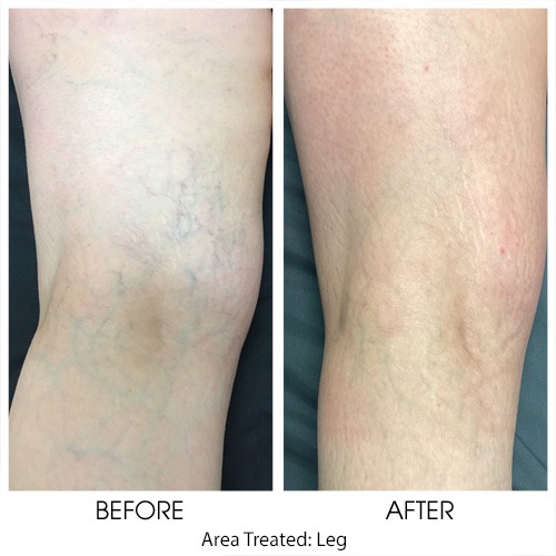Before + After Gallery: Body