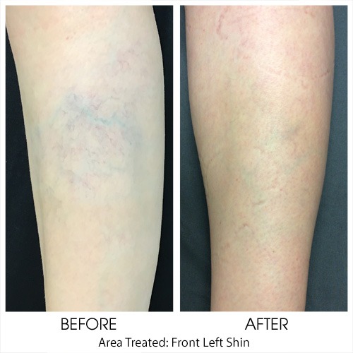Before + After Gallery: Body