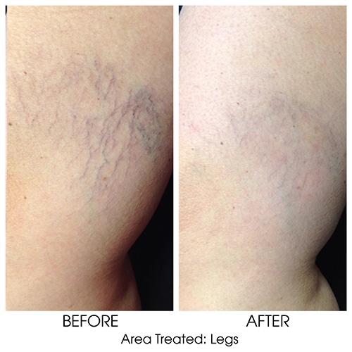 Before + After Gallery: Body