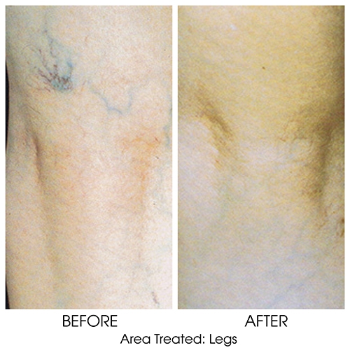 Before + After Gallery: Body