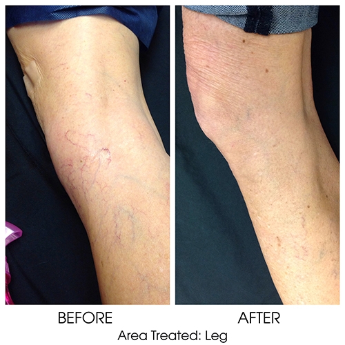 Before + After Gallery: Body