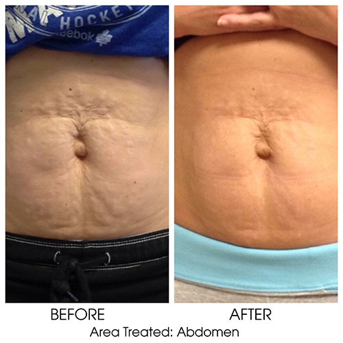 Before + After Gallery: Face