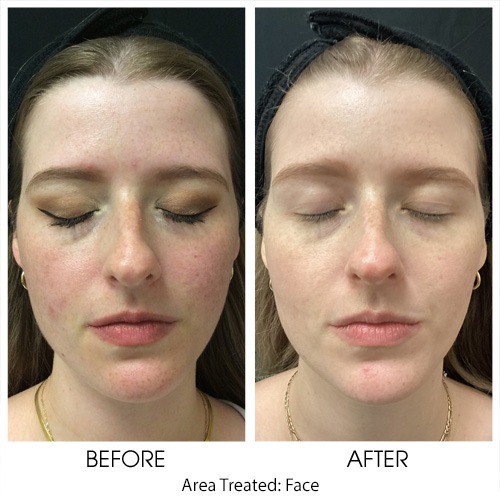 Before + After Gallery: Face