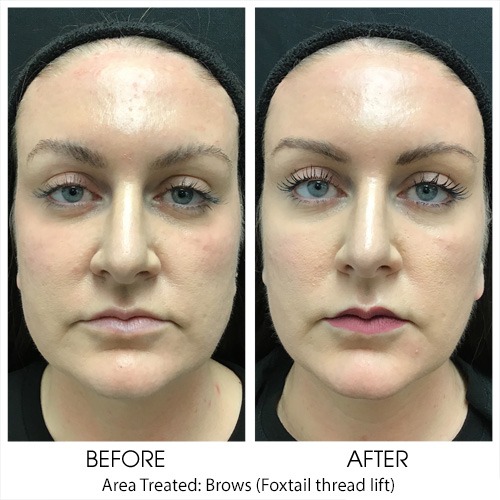 Before + After Gallery: Face