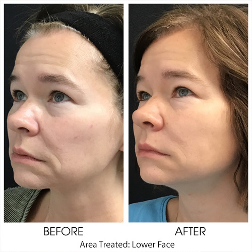 Before + After Gallery: Face