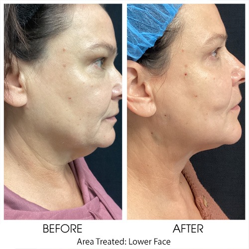Before + After Gallery: Face