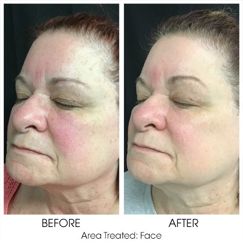 Before + After Gallery: Face