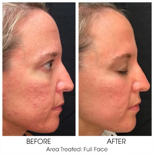 Before + After Gallery: Face