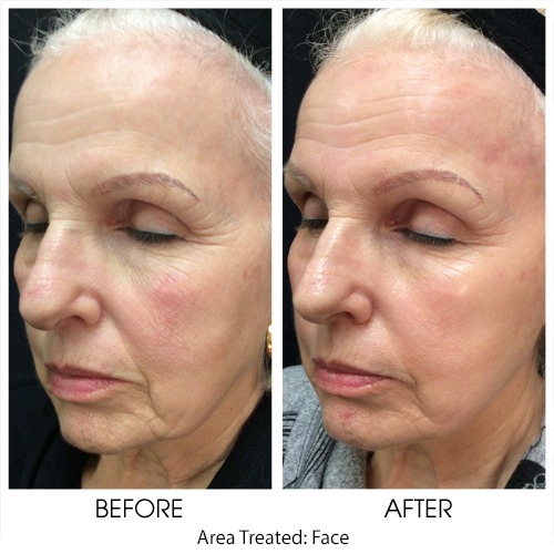 Before + After Gallery: Face