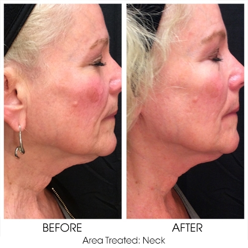 Before + After Gallery: Face