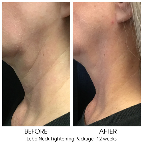 Before + After Gallery: Face