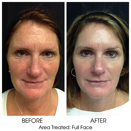 Before + After Gallery: Face