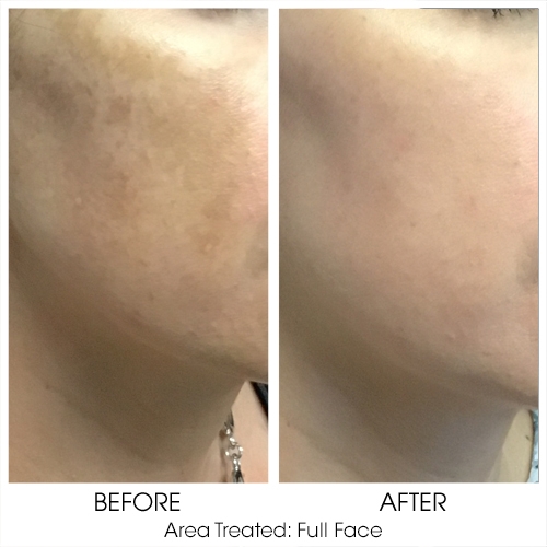 Before + After Gallery: Face