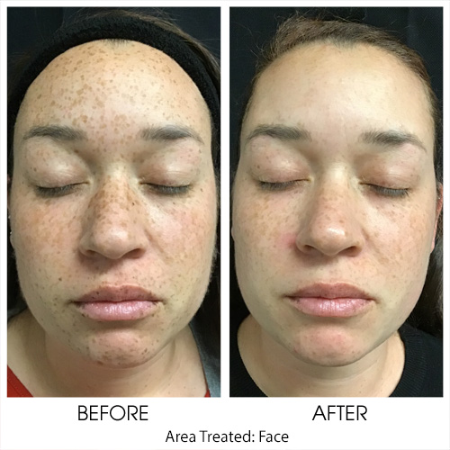 Before + After Gallery: Face