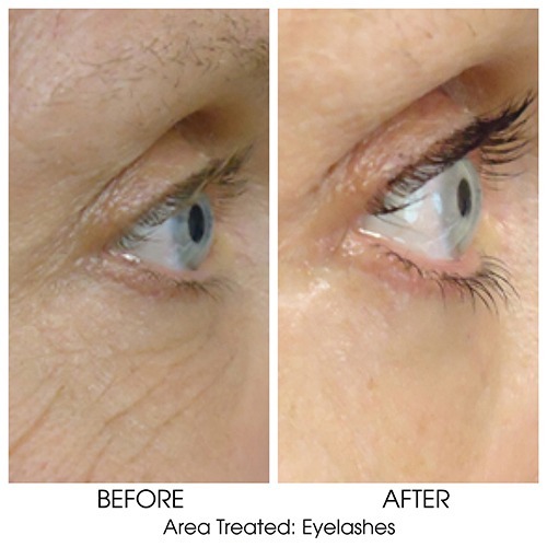 Before + After Gallery: Face