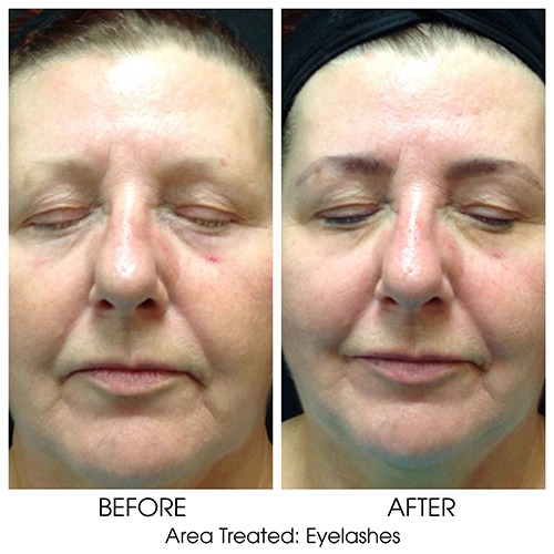 Before + After Gallery: Face