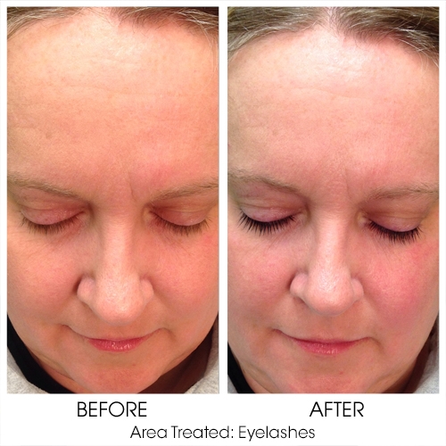 Before + After Gallery: Face