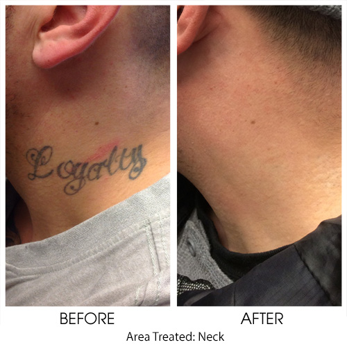 Before + After Gallery: Body